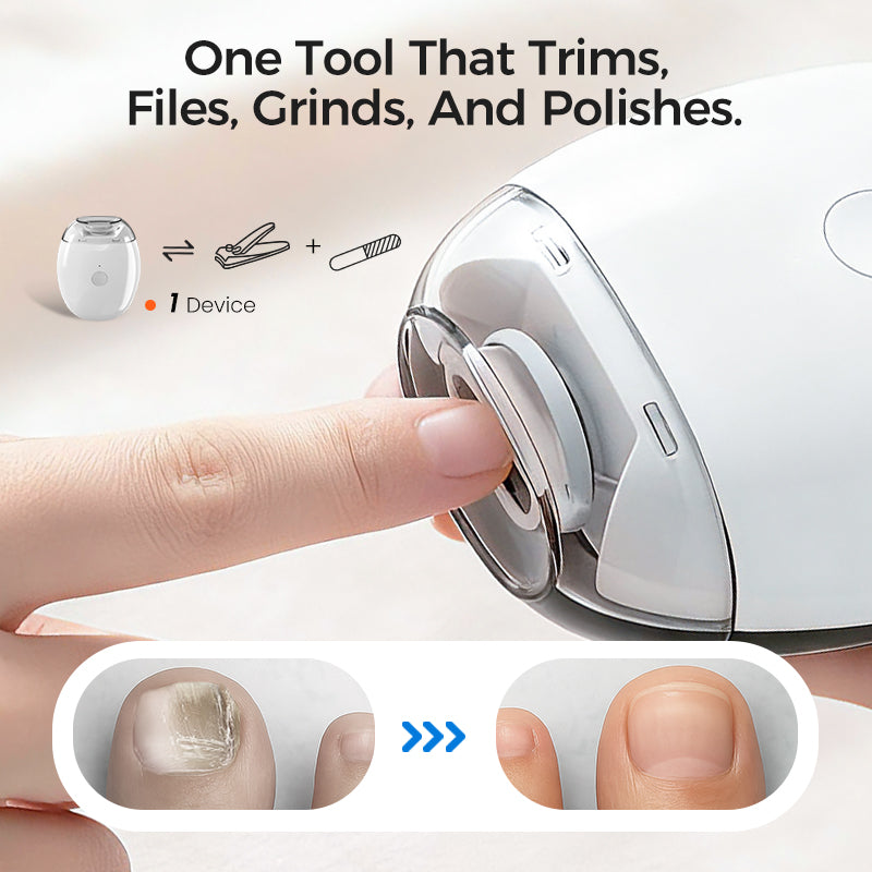 NailGlide – Electric Nail Grinder for All Ages