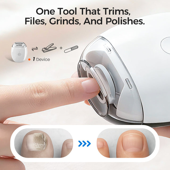 NailGlide – Electric Nail Grinder for All Ages